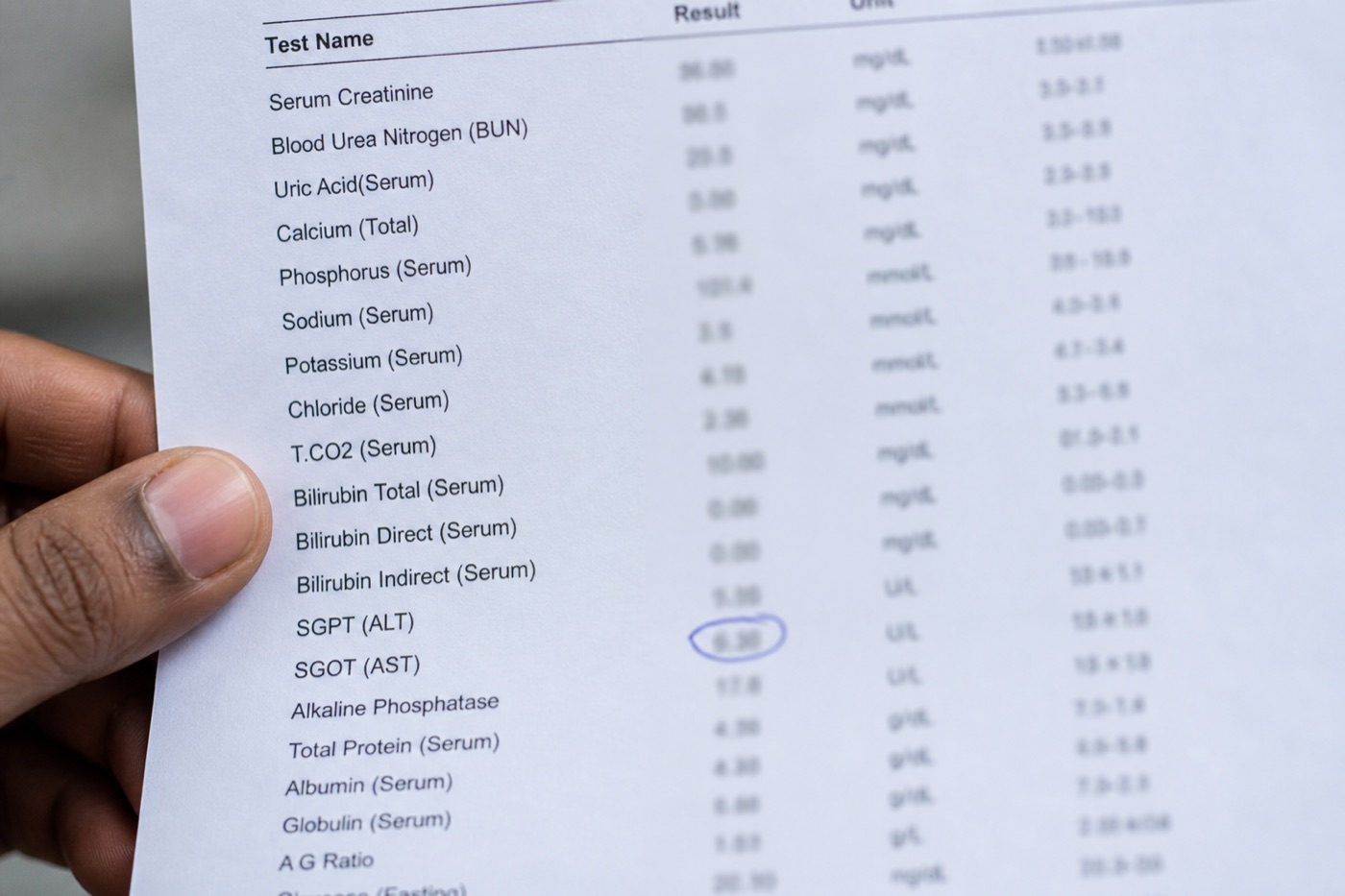 Close-up of a printed lab report with a circled result